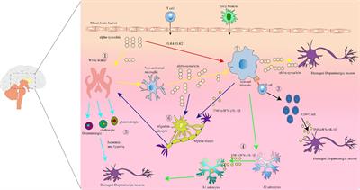 The mechanisms of white matter injury and immune system crosstalk in promoting the progression of Parkinson’s disease: a narrative review